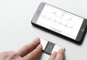 Alivecor Personal Electrocardiogram Enters India